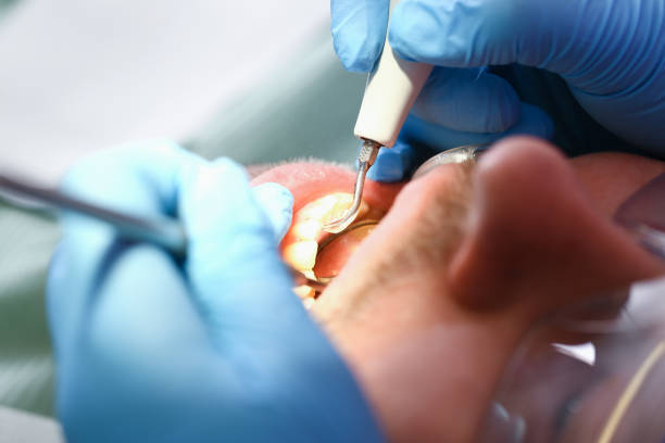 Best Emergency Denture Repair in Port Ewen, NY