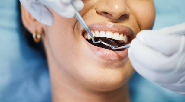 Best Emergency Treatment for Dental Infections or Abscesses in Port Ewen, NY